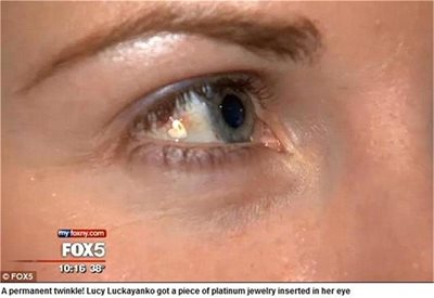 Девойка имплантира бижу в окото си