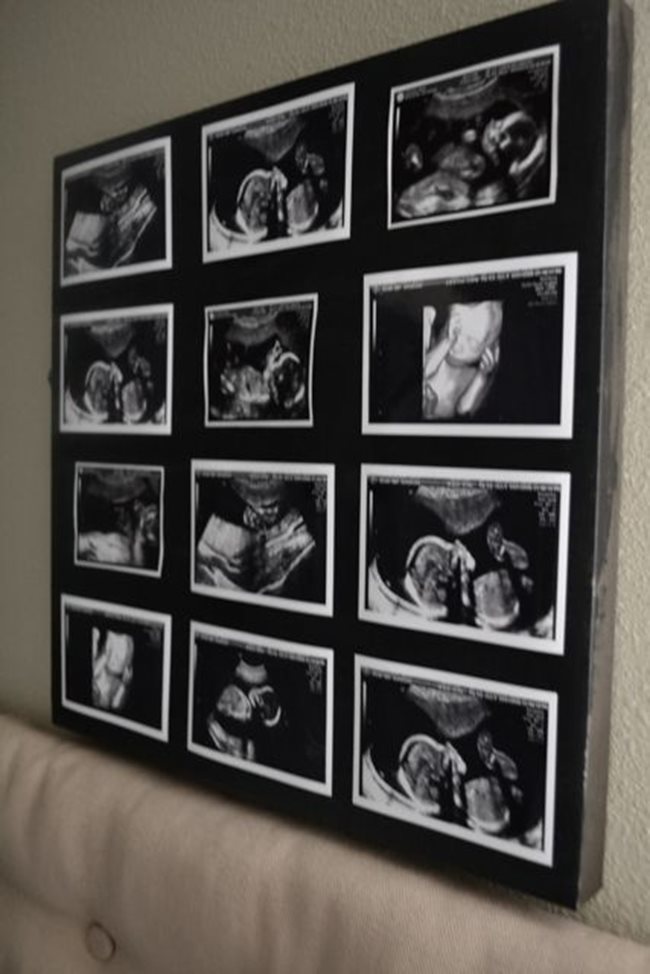 Снимките от ехографа при всяко посещение при гинеколога можете да ползвате за картина, която да остани завинаги в детската стая. Не е ли очарователно?