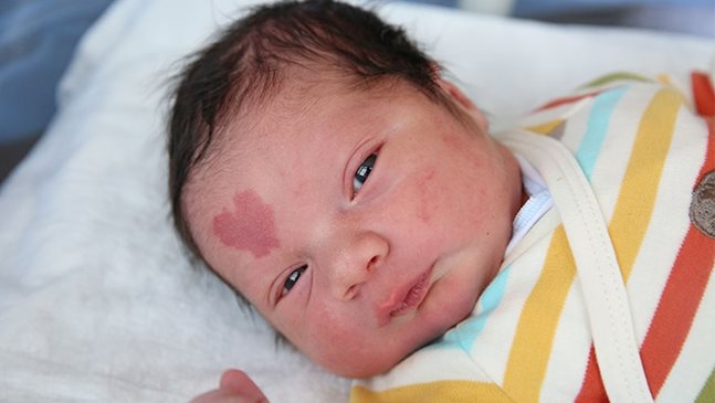 Бебе се роди с белег под формата на сърце