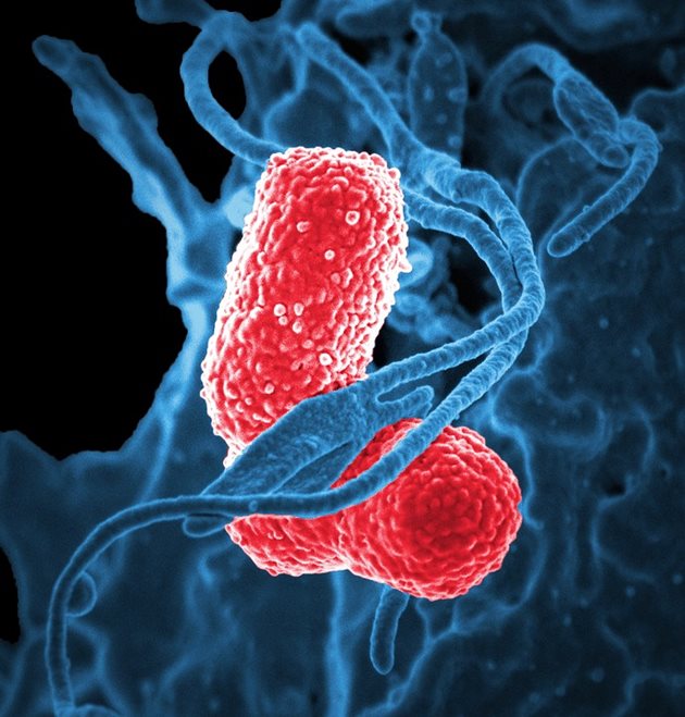 Бактерия, причиняваща пневмония