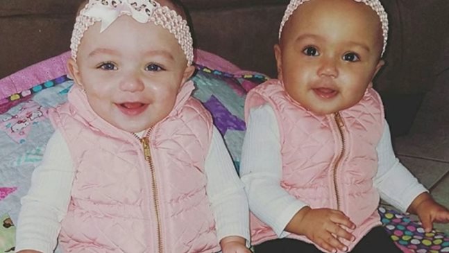Жена роди близначки с различен цвят на кожата (Снимки+Видео)