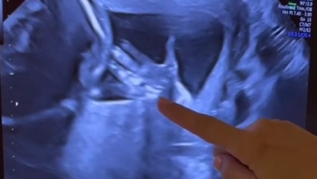 Бременната Джулиана Гани: Вижте кой ви маха от екрана на ехографа! (Видео)