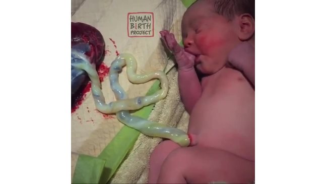 Нова противоречива мания в интернет: Снимки на бебета с плацента