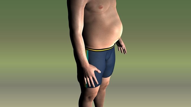 Едно от пет български деца е дебело