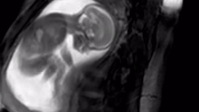 Кадри на неродено от корема на майката (Видео)