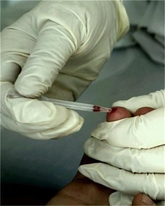 След като бе изпробван върху 393-ма доброволци от 5 страни - САЩ, Руанда, Уганда, РЮА и Тайланд, прототипът на ваксина предизвика имунен отговор - производство на антитела, у всички участници. СНИМКА: Архив