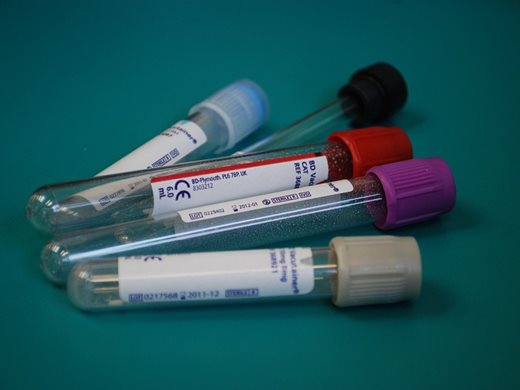 Великобритания започва мащабни изпитания на кръвен тест за 50 вида рак
